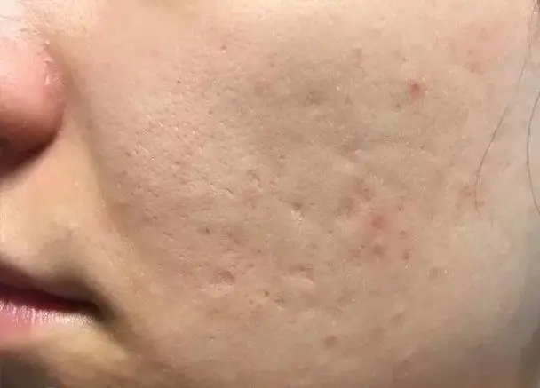 16c4a3964268e6af5642f3d23fdf51de_u=2394247484,1850277181&fm=253&fmt=auto&app=138&f=JPEG_w=608&h=437.webp 16c4a3964268e6af5642f3d23fdf51de_u=2394247484,1850277181&fm=253&fmt=auto&app=138&f=JPEG_w=608&h=437.webp