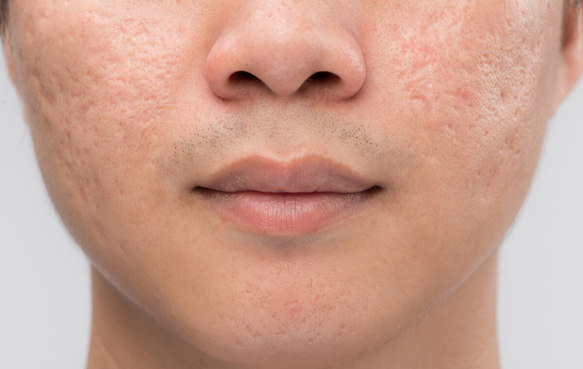 f9b91bb781c35bc0070d142f0698faaa_9fe7f0bb552a439abbf33a16a3c4a23b_from=pc.png f9b91bb781c35bc0070d142f0698faaa_9fe7f0bb552a439abbf33a16a3c4a23b_from=pc.png