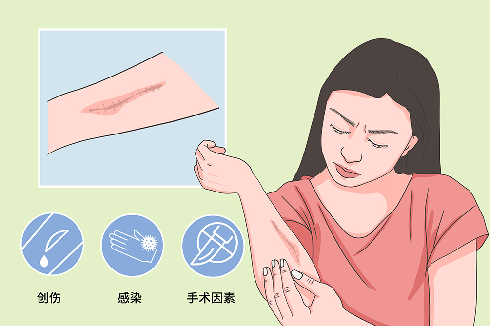 有疤痕不能吃什么
