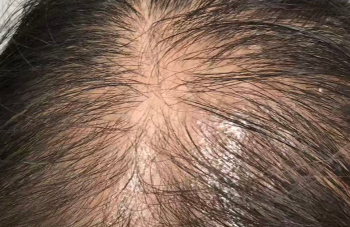 红枣：藏在发丝间的“红色宝藏”，防脱秘密你知道吗？